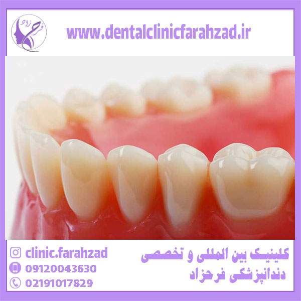 انواع دندان ها و ساختار آنها و کاربرد