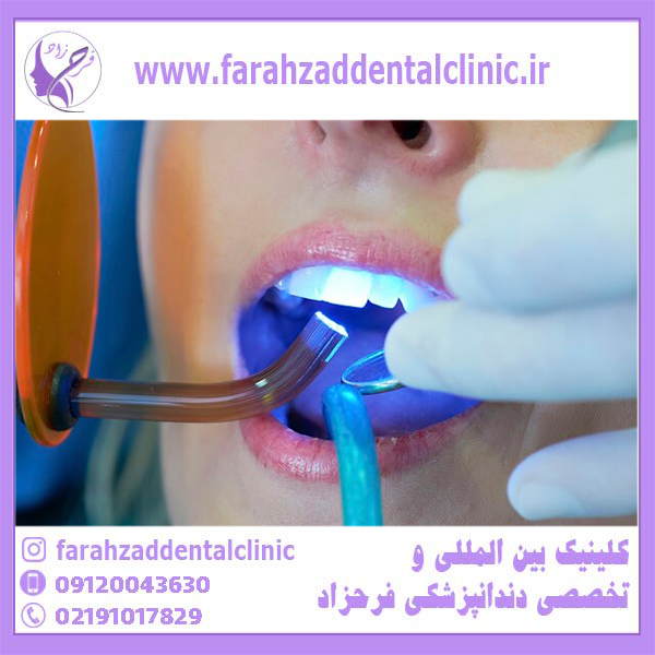 کاربرد پلاسما در دندانپزشکی